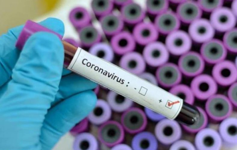 Armenia has 329 coronavirus cases