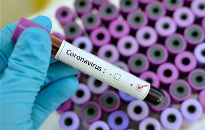 Количество подтвержденных случаев заражения коронавирусом в Армении достигло 663