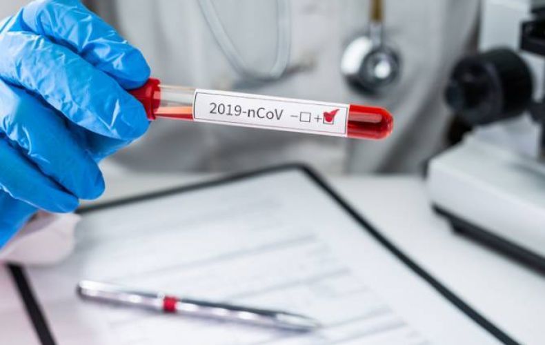 В Армении зарегистрировано 20 новых случаев заражения коронавирусом