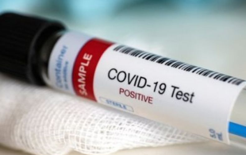 Record number of 351 COVID-19 cases registered in Armenia in 1 day