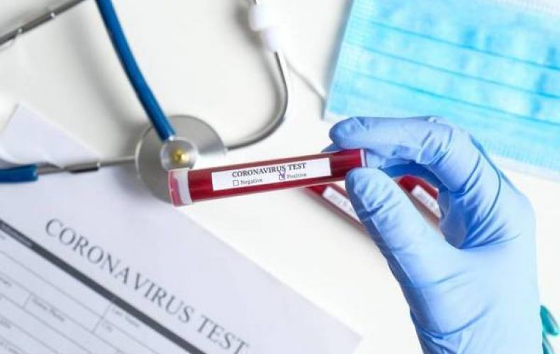 373 people in Armenia infected with COVID-19 in one day