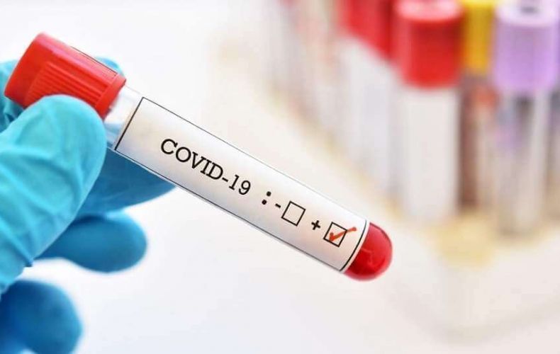 Արցախում հայտնաբերվել է կորոնավիրուսով վարակվելու 21 նոր դեպք