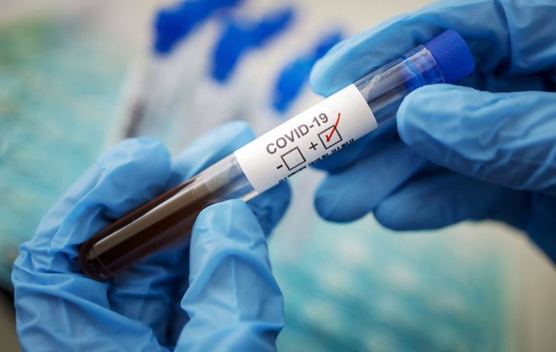 В Арцахе выявлено 4 случая заболевания коронавирусом
