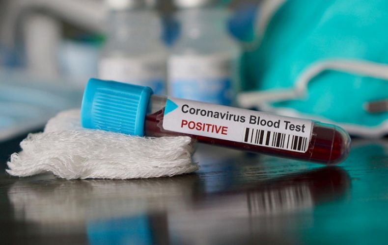 Зафиксировано девять новых случаев заражения коронавирусом, состояние пятерых пациентов врачи оценивают как крайне тяжелое